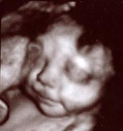peanut 4D